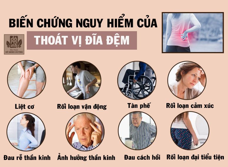 Odoo • Hình ảnh với chú thích